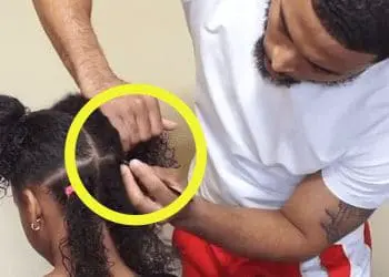 Girl Has An Itch On Her Head – Then Her Father Discovers Something Strange…