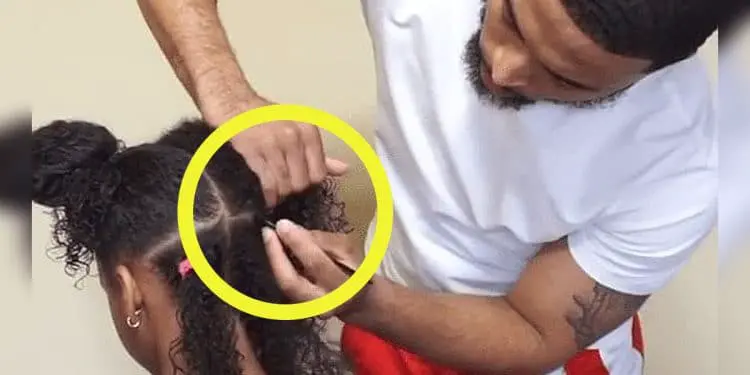 Girl Has An Itch On Her Head – Then Her Father Discovers Something Strange…
